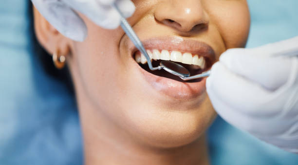 Best Emergency Treatment for Dental Infections or Abscesses in Mystic, CT